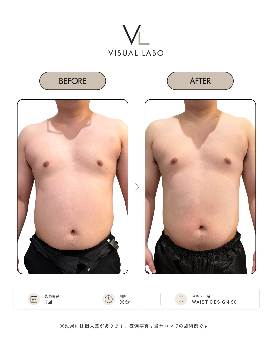 ビフォーアフター 男性 正面|BODY MAINTENANCE MENU