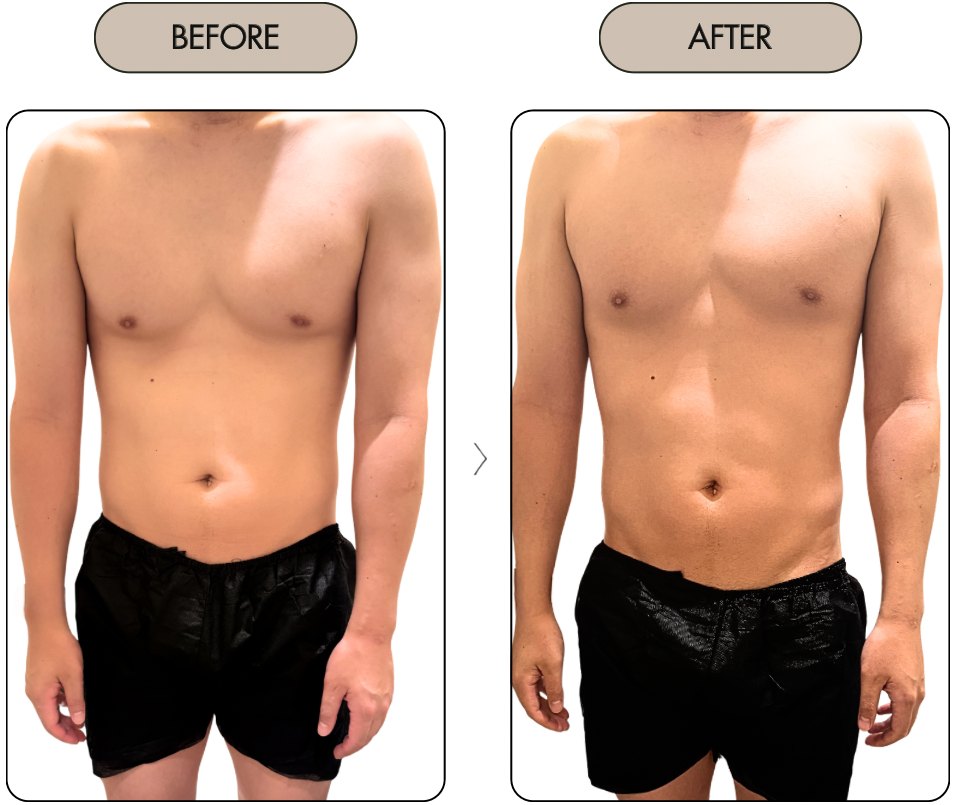 ビフォーアフター 男性 正面(90分・施術1回)|BODY MAINTENANCE